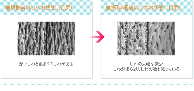 ■摂取前のしわの状態（目尻）