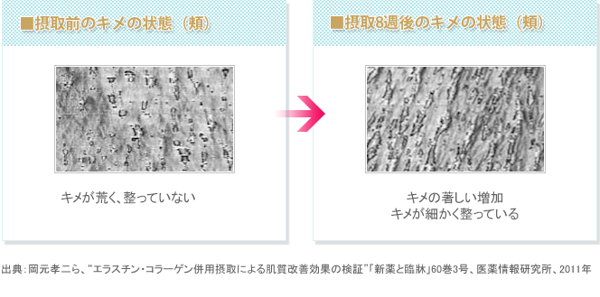 ■摂取前のキメの状態（目尻）